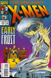 UXM 314