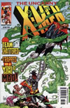 UXM 374